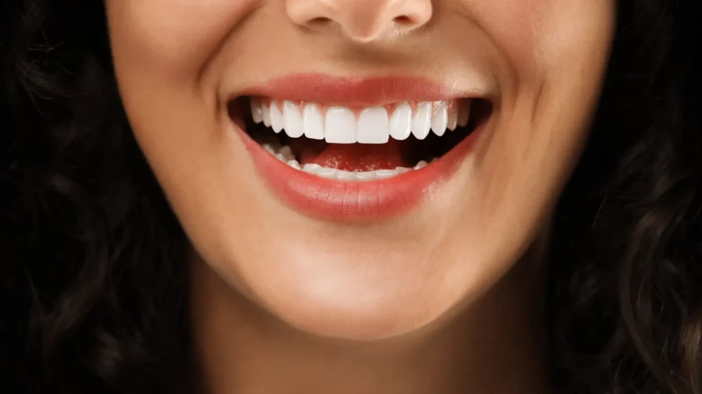 A close-up of a smiling person shows bright white teeth and full red lips. The image conveys happiness and warmth, with dark, curly hair framing the face.