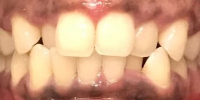 close up of teeth