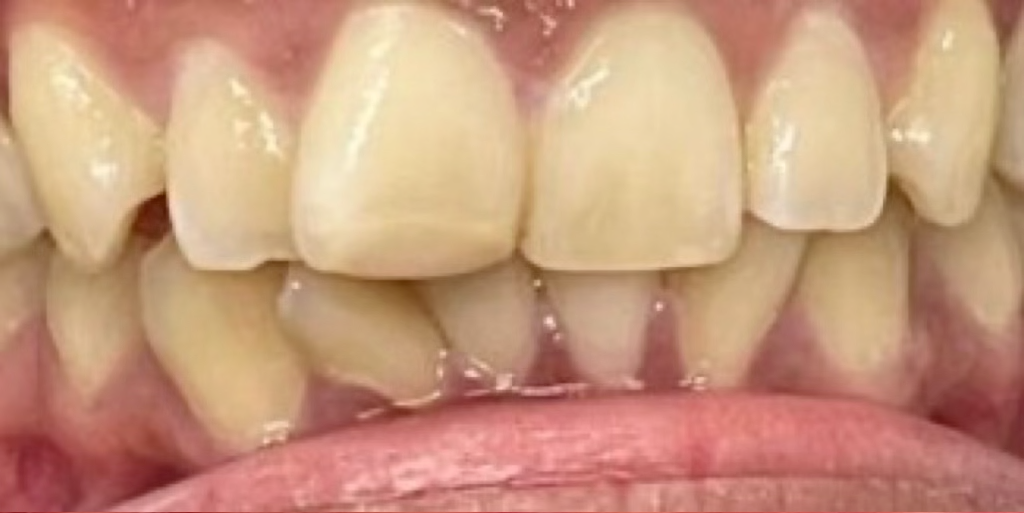 close up of teeth