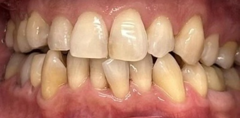 close up of teeth